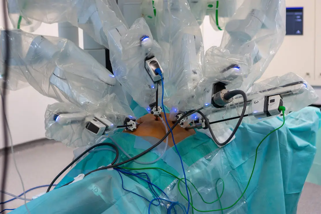 Cirugía robótica con el sistema Da Vinci en el Hospital Universitario Santa Bárbara de Soria