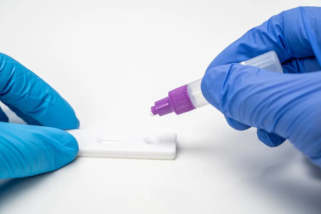 Imagen de un test para la detección de coronavirus.
