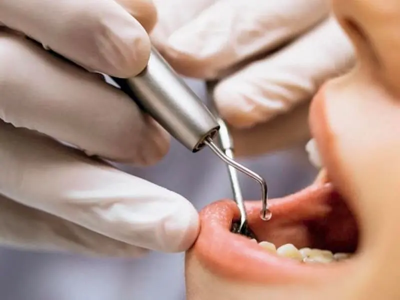 El Gobierno destina 3,4 millones de euros a Castilla y León para ampliar la cartera bucodental