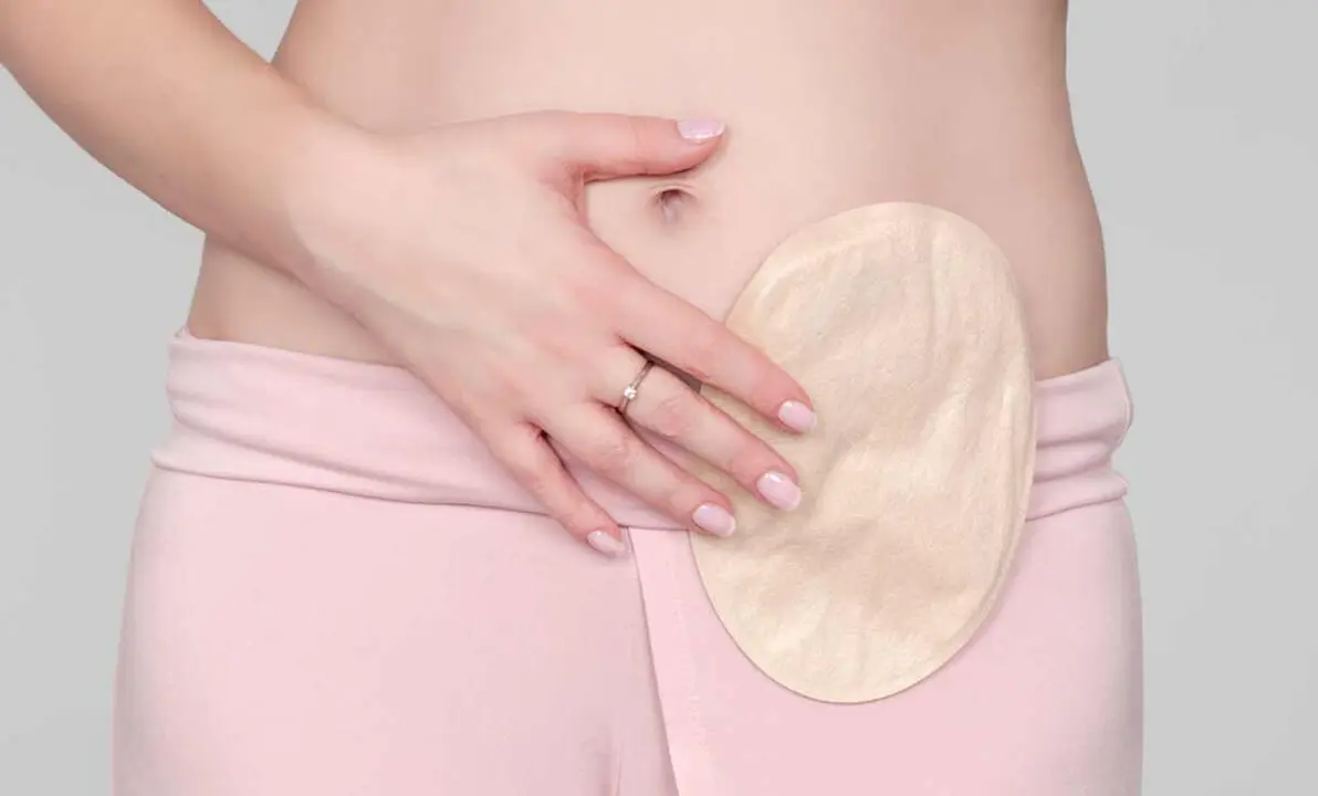 ostomizado1