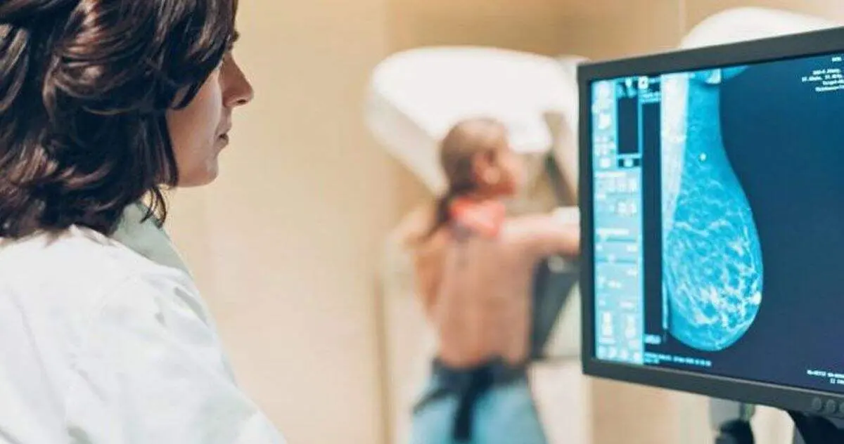 cáncer de mama 2