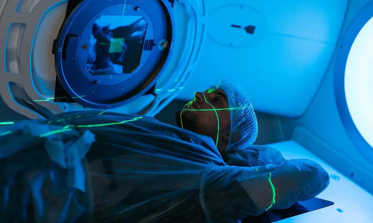 Imagen de un tratamiento de radioterapia.