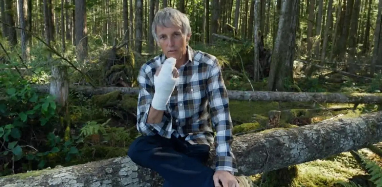 Jes&uacute;s Calleja muestra su mano tras fracturarse los dedos.