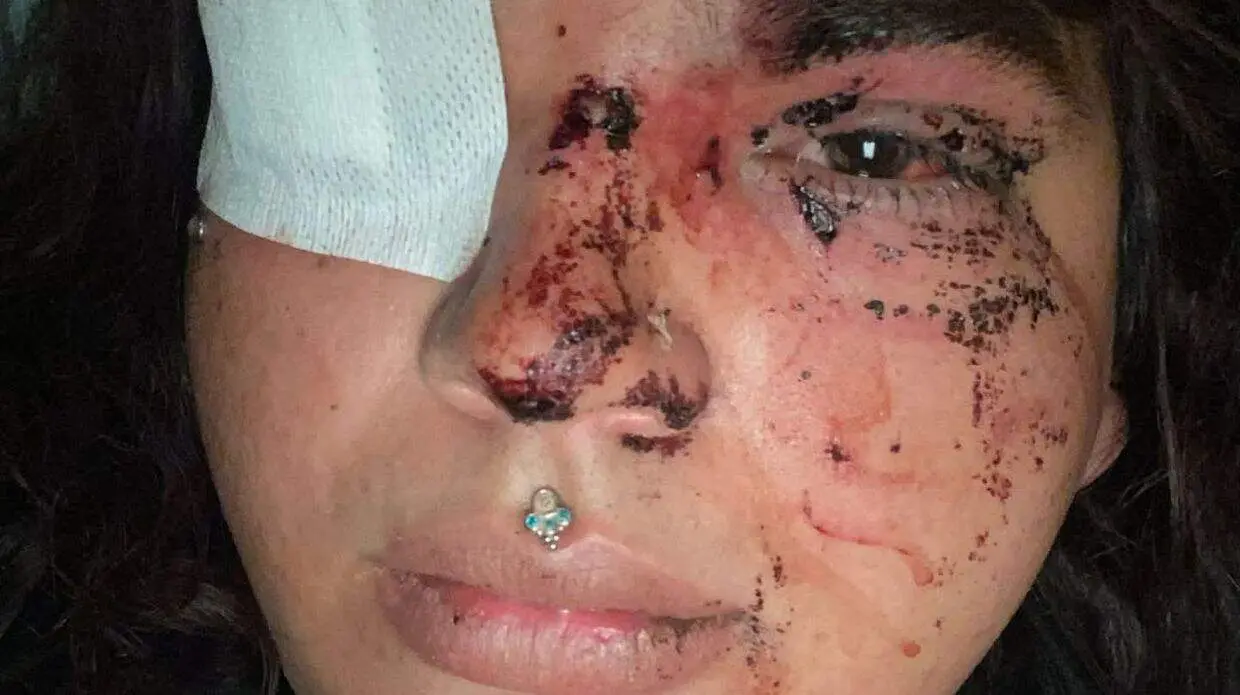 Bianca Lizbeth, la mujer agredida este fin de semana en un pub de La Ba&ntilde;eza