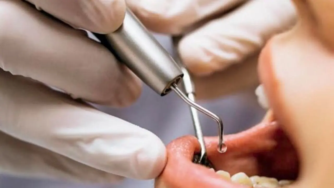 El Gobierno destina 3,4 millones de euros a Castilla y León para ampliar la cartera bucodental