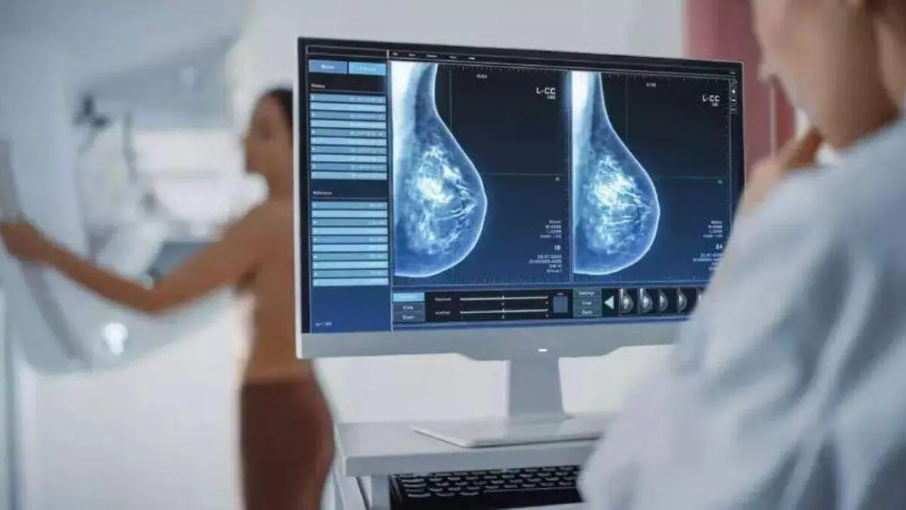 Una mujer se somete a una mamografía preventiva frente al cáncer de mama.