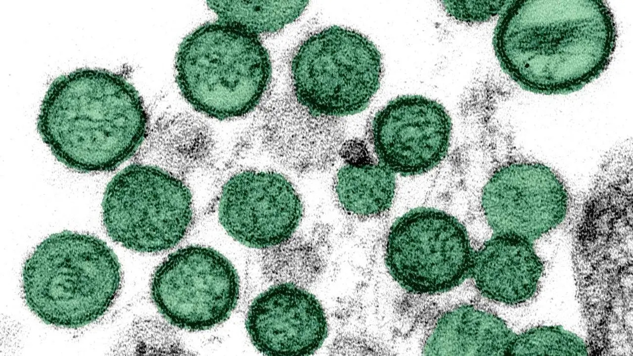 Hantavirus