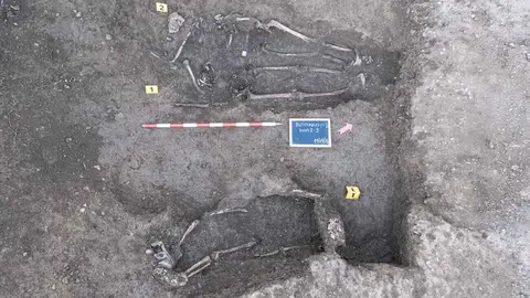 Exhumaciones realizadas durante los trabajos acometidos en Busdondo (36)