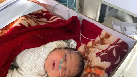 Un bebé prematuro es tratado en una incubadora del Hospital Provincial de Maidan Wardak, en Afganistán. Foto: Alfonso F. Reca