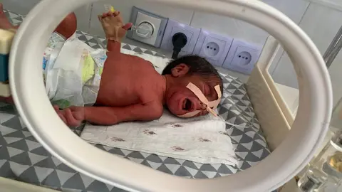 Un bebé prematuro es tratado en una incubadora del Hospital Provincial de Maidan Wardak, en Afganistán. Foto: Alfonso F. Reca