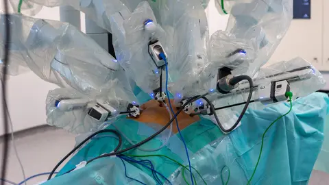 Cirugía robótica con el sistema Da Vinci en el Hospital Universitario Santa Bárbara de Soria. Foto: Concha Ortega.