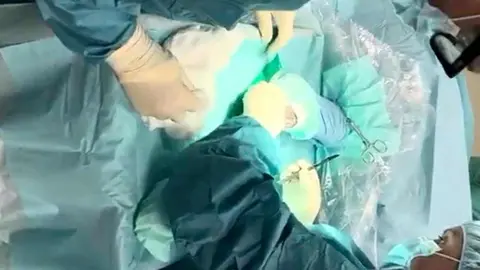 El burrito 'Pablete', un ejemplar enano de apenas ocho meses de edad y unos 80 kilos de peso, ha logrado salir adelante gracias a una operación poco habitual realizada en el Hospital Veterinario de la Universidad de León.