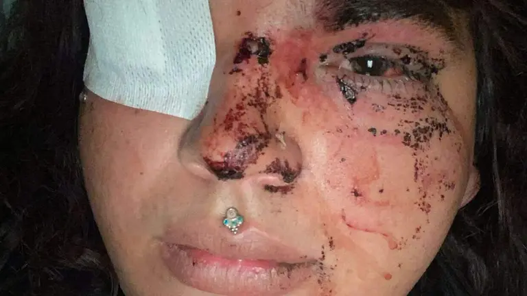 Bianca Lizbeth, la mujer agredida este fin de semana en un pub de La Ba&ntilde;eza
